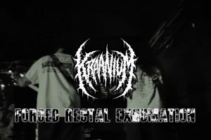 Forced Rectal Exhumation 